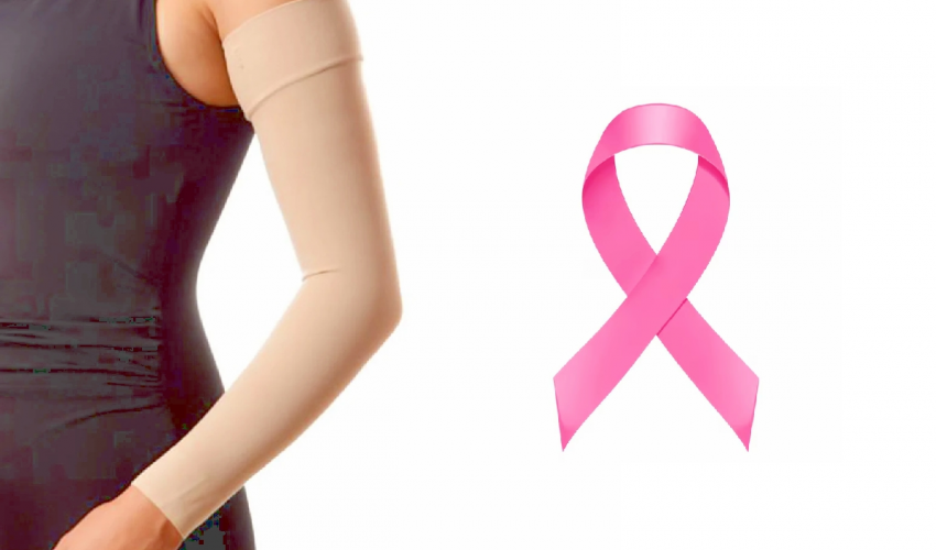 Mangas para linfedema y linfedema relacionado a cancer de mama